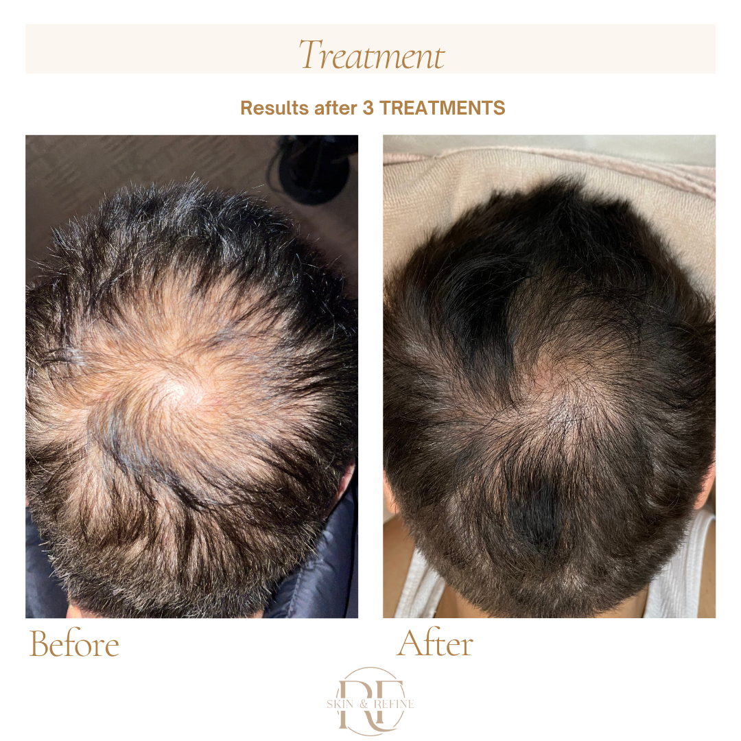 Hair & Scalp Restoration Package