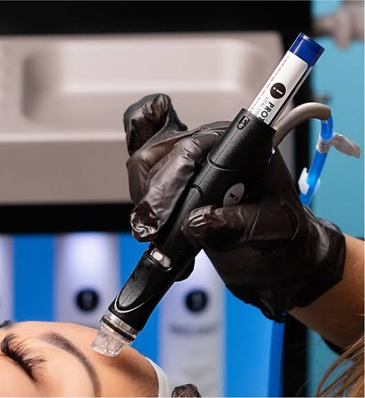 Hydrafacial in Edmonton: Benefits, Results and Treatment Options