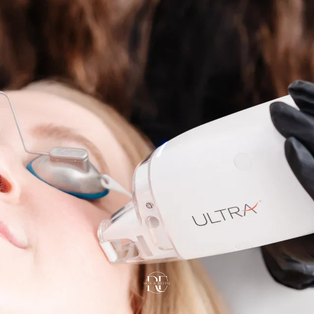 Ultra Laser - Hair Restoration / Pigmentation 1st-Client Offer